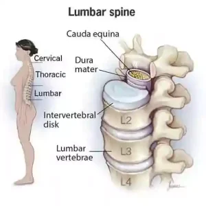 What is Lumbar